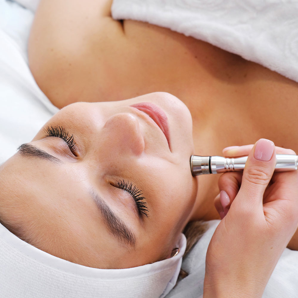mikrodermabrazia