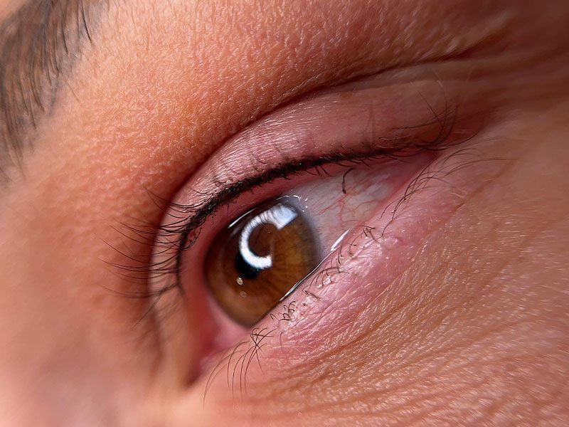 Detail medziriasovej očnej linky Marcelle Esthétique Pezinok